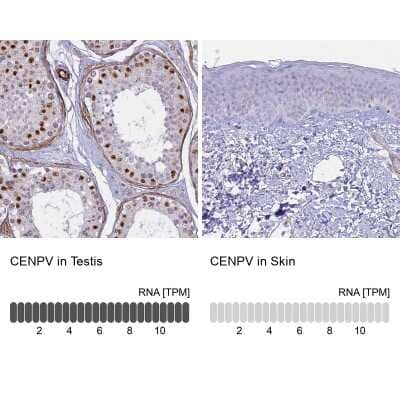 Immunohistochemistry-Paraffin: CENPV Antibody [NBP1-84545]