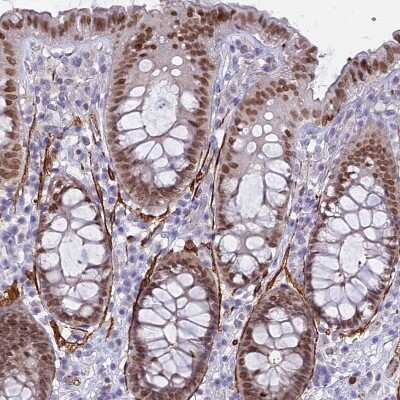 Immunohistochemistry-Paraffin: CENPV Antibody [NBP1-84545]