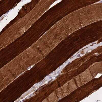 Immunohistochemistry-Paraffin: CENPV Antibody [NBP1-84545]
