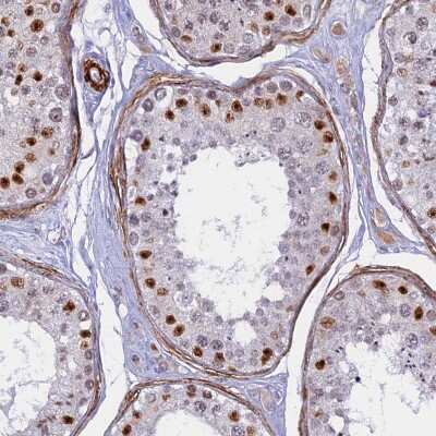 Immunohistochemistry-Paraffin: CENPV Antibody [NBP1-84545]