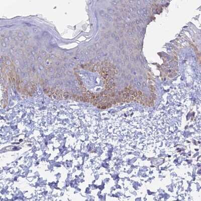 Immunohistochemistry-Paraffin: CENPV Antibody [NBP1-84546]