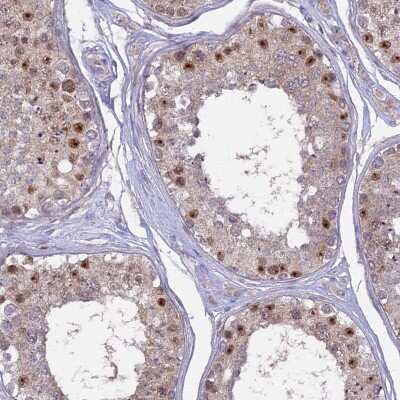 Immunohistochemistry-Paraffin: CENPV Antibody [NBP1-84546]