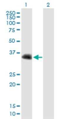 Western Blot: CENPV Antibody [H00201161-B01P]