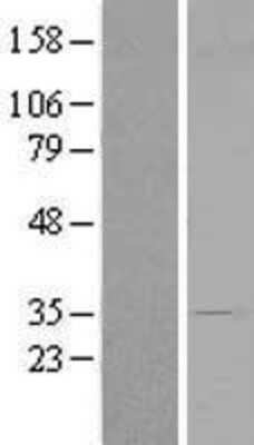 Western Blot: CENPV Overexpression Lysate [NBL1-14835]