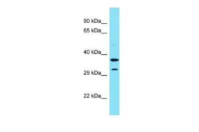 Western Blot: CENPVL1 Antibody [NBP3-09699]