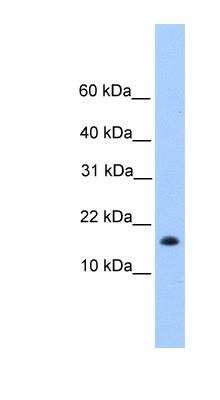 Western Blot: CENPW Antibody [NBP1-70496]