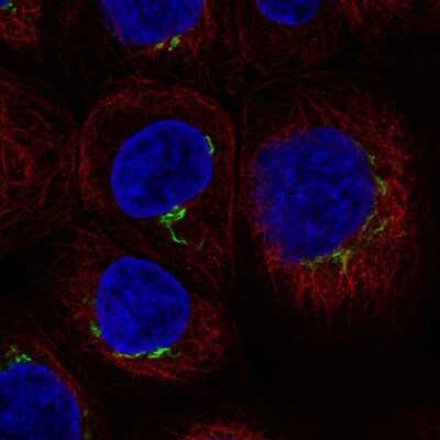 Immunocytochemistry/ Immunofluorescence: CENTB1 Antibody [NBP2-69009]