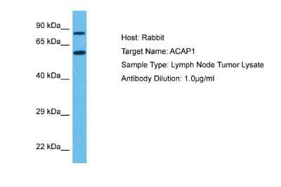 Western Blot: CENTB1 Antibody [NBP2-84651]