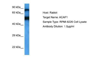 Western Blot: CENTB1 Antibody [NBP2-84652]