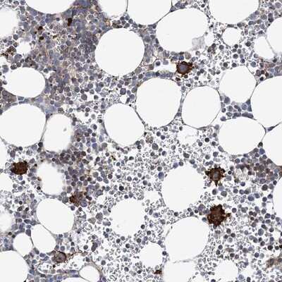 Immunohistochemistry-Paraffin: CENTD1 Antibody [NBP1-84542]