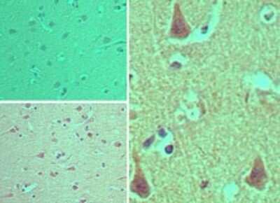 Immunohistochemistry-Paraffin: CENTD1 Antibody [NBP2-24620]