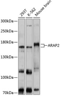 Western Blot: CENTD1 AntibodyAzide and BSA Free [NBP2-92070]