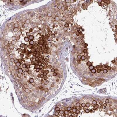 Immunohistochemistry: CEP110 Antibody [NBP2-49013]