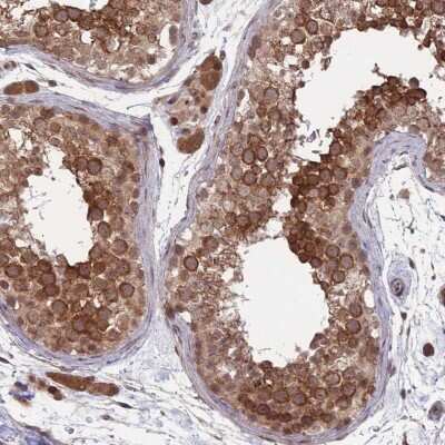 Immunohistochemistry-Paraffin: CEP110 Antibody [NBP2-48548]