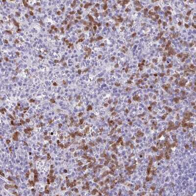 Immunohistochemistry: CEP120 Antibody [NBP2-49011]