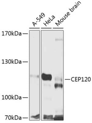 Western Blot: CEP120 AntibodyBSA Free [NBP2-92822]