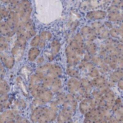 Immunohistochemistry: CEP128 Antibody [NBP1-89899]