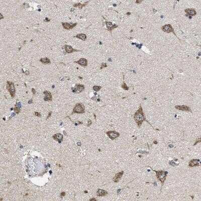 Immunohistochemistry-Paraffin: CEP128 Antibody [NBP1-89898]