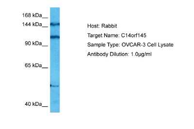 Western Blot: CEP128 Antibody [NBP2-87170]