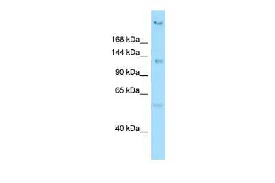 Western Blot: CEP135 Antibody [NBP3-10683]