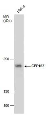 Western Blot: CEP152 Antibody (1285) [NBP2-43722]