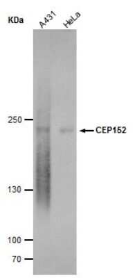 Western Blot: CEP152 Antibody (1315) [NBP2-43721]