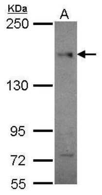 Western Blot: CEP164 Antibody (13) [NBP2-43631]