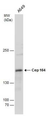 Western Blot: CEP164 Antibody (13) [NBP2-43631]