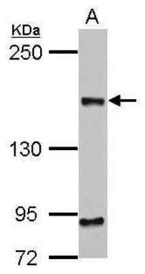 Western Blot: CEP164 Antibody (17) [NBP2-43707]