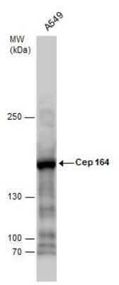 Western Blot: CEP164 Antibody (17) [NBP2-43707]