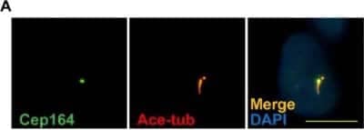 Immunocytochemistry/ Immunofluorescence: CEP164 Antibody [NBP1-81445]