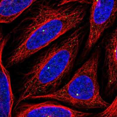 Immunocytochemistry/ Immunofluorescence: CEP164 Antibody [NBP2-68776]