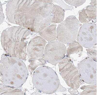 Immunohistochemistry-Paraffin: CEP164 Antibody [NBP1-81445]