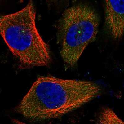 Immunocytochemistry/ Immunofluorescence: CEP170 Antibody [NBP2-34074]