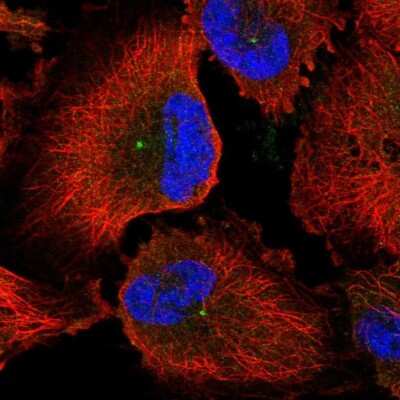 Immunocytochemistry/ Immunofluorescence: CEP170 Antibody [NBP2-68664]