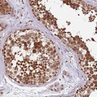 Immunohistochemistry: CEP170 Antibody [NBP2-33449]