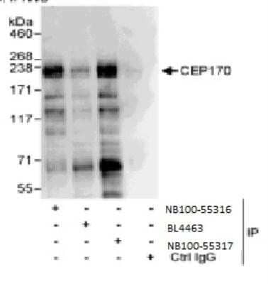Immunoprecipitation: CEP170 Antibody [NB100-55317]