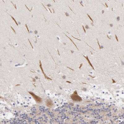 Immunohistochemistry-Paraffin: CEP170B Antibody [NBP2-31992]