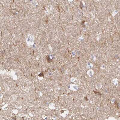 Immunohistochemistry-Paraffin: CEP170B Antibody [NBP2-31992]