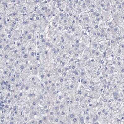 Immunohistochemistry-Paraffin: CEP170B Antibody [NBP2-31992]