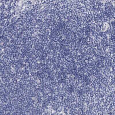Immunohistochemistry-Paraffin: CEP170B Antibody [NBP2-31992]
