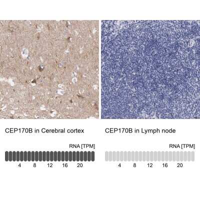 Immunohistochemistry-Paraffin: CEP170B Antibody [NBP2-31992]