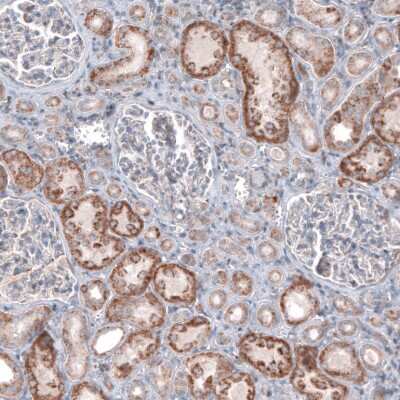 Immunohistochemistry-Paraffin: CEP192 Antibody [NBP1-84634]