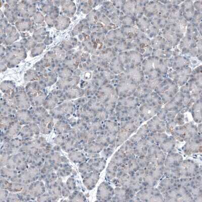 Immunohistochemistry-Paraffin: CEP192 Antibody [NBP1-84634]