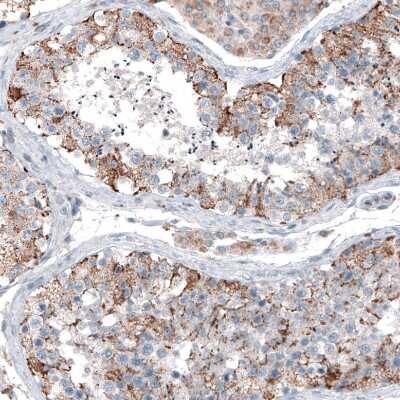 Immunohistochemistry-Paraffin: CEP192 Antibody [NBP1-84634]