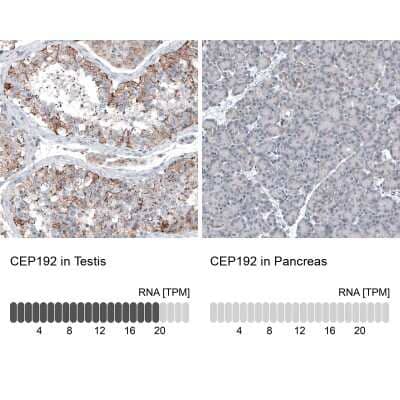 Immunohistochemistry-Paraffin: CEP192 Antibody [NBP1-84634]