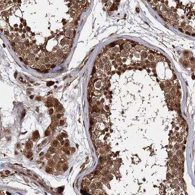 Immunohistochemistry-Paraffin: CEP192 Antibody [NBP1-84635]