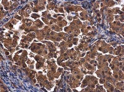 Immunohistochemistry-Paraffin: CEP192 Antibody [NBP3-13048]