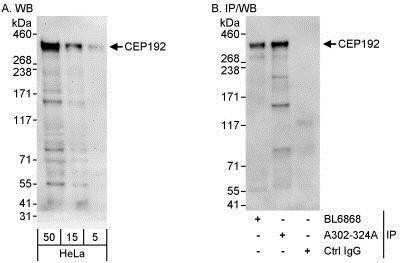 Western Blot: CEP192 Antibody [NBP1-28718]