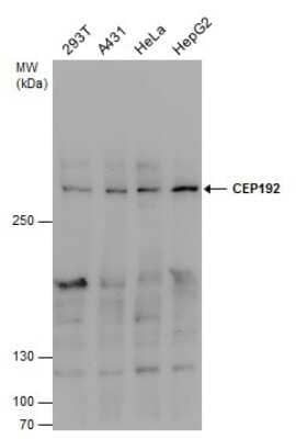 Western Blot: CEP192 Antibody [NBP3-13048]